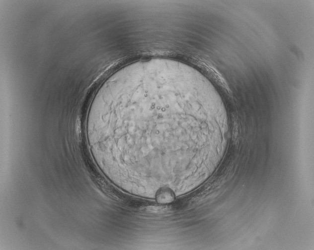 X0000115170251200911181412