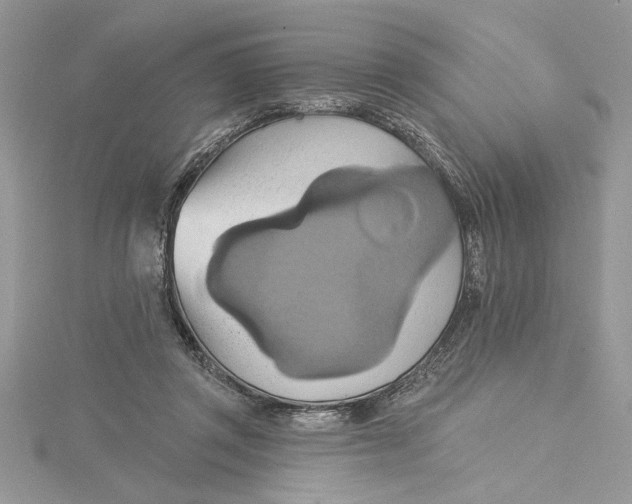 X0000115170357200911181411