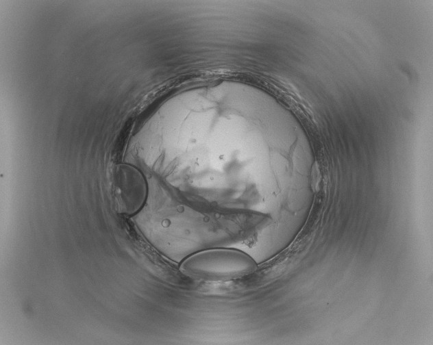 X0000115170366200911181411