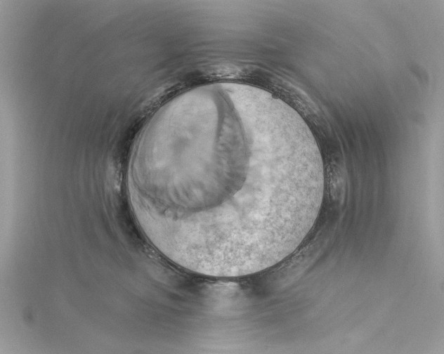 X0000115170374200911181411