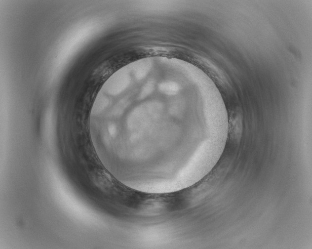 X0000115170381200911181411