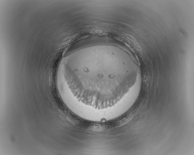 X0000115170416200911181410