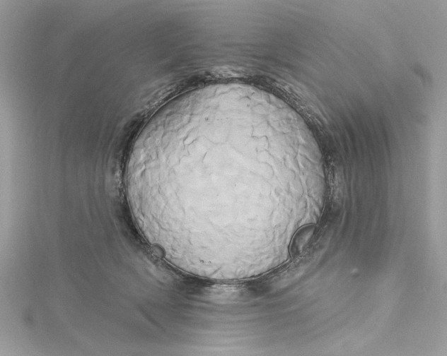 X0000115170418200911181410