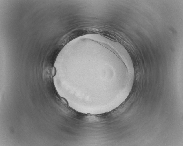 X0000115170425200911181410