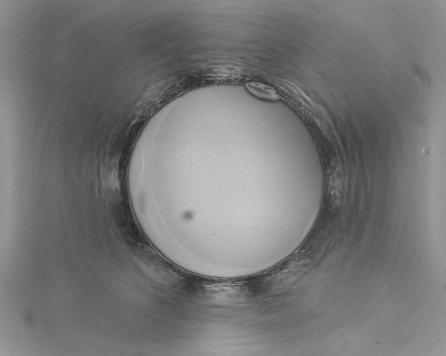 X0000115170516200911181409