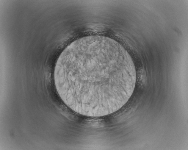 X0000115170615200911181407