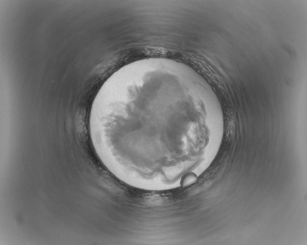 X0000115170616200911181407