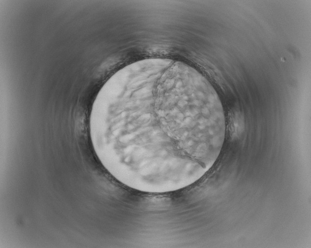 X0000115170619200911181407