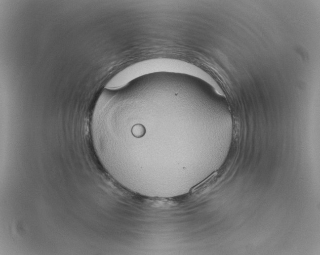 X0000115170621200911181407