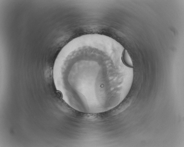 X0000115170624200911181407