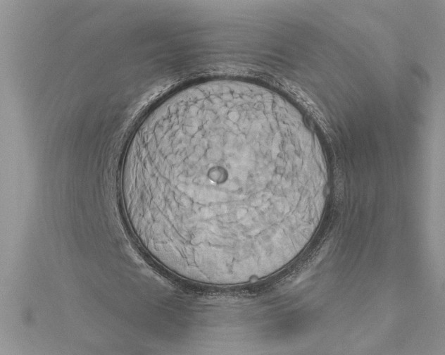 X0000115170625200911181406