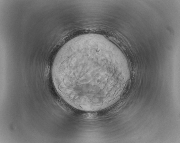 X0000115170660200911181407