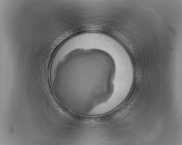 X0000115170721200911181405