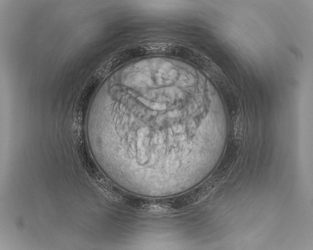 X0000115170737200911181405