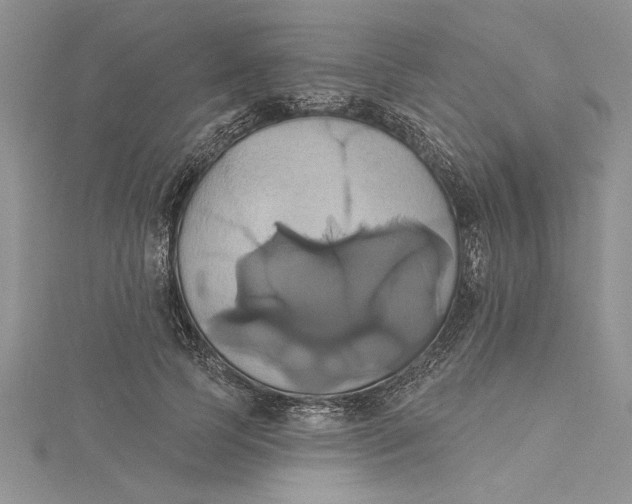 X0000115170745200911181405