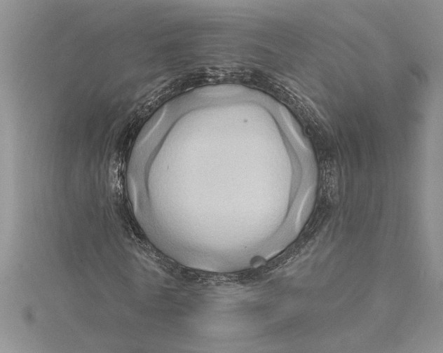 X0000115170770200911181405