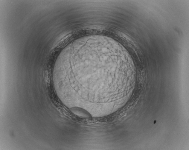 X0000115170774200911181405