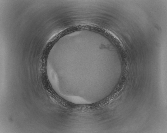 X0000115170775200911181405