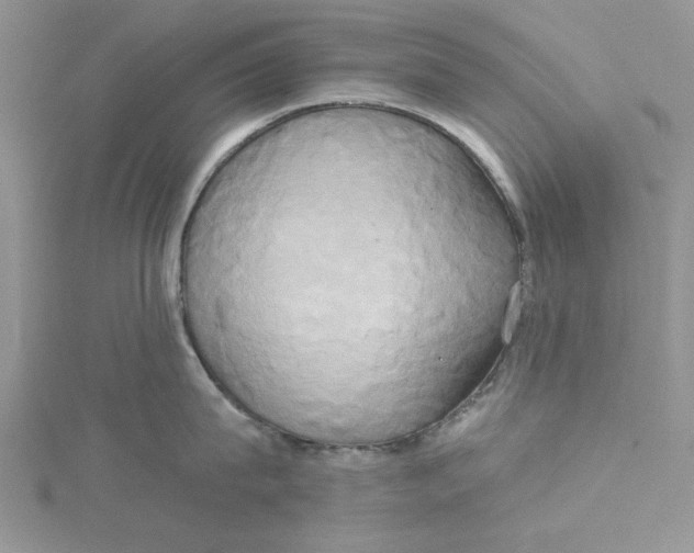 X0000115170815200911181404