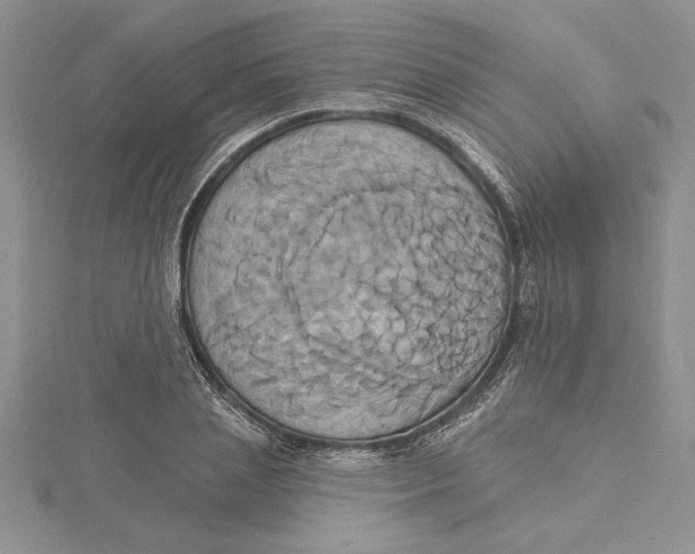 X0000115170837200911181404