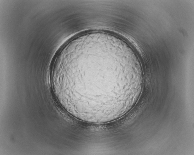 X0000115170887200911181403