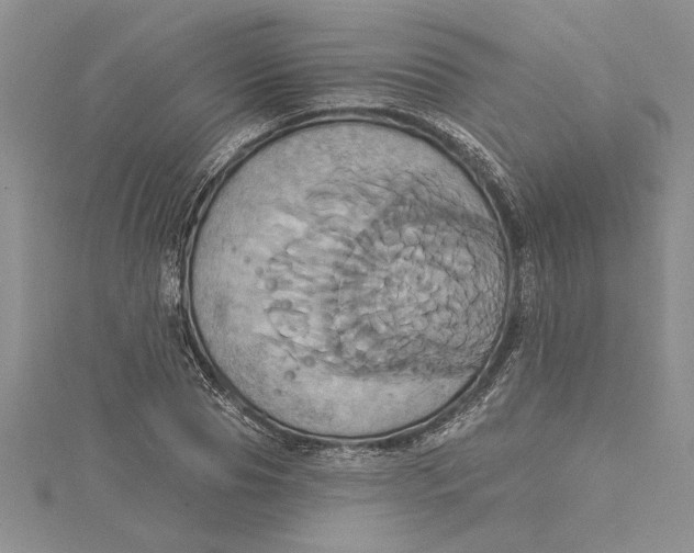 X0000115170929200911181402