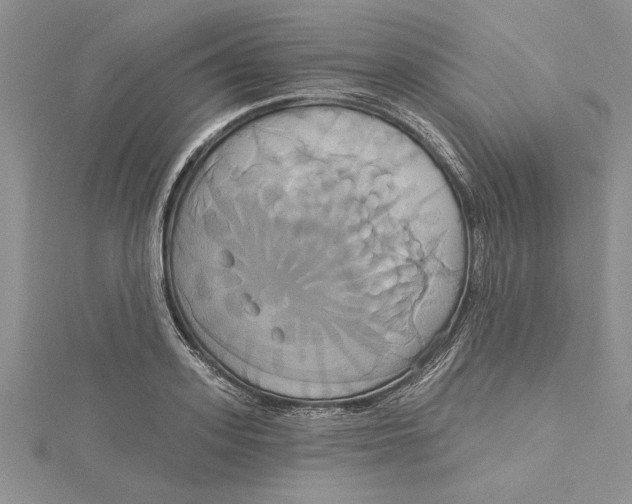 X0000115170939200911181402