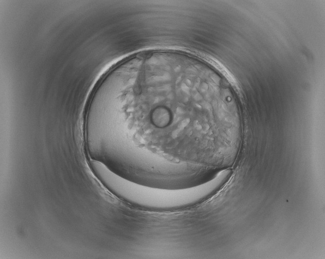 X0000115170996200911181401