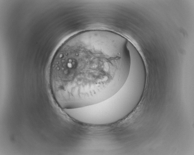 X0000115171008200911181401