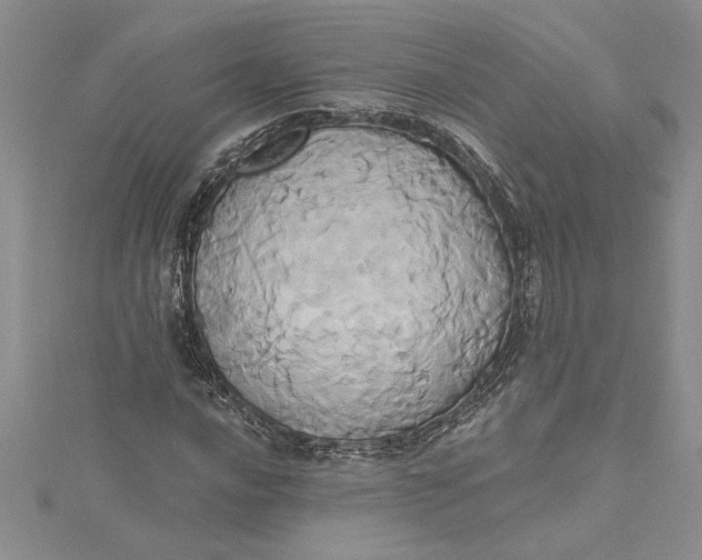 X0000115171016200911181401