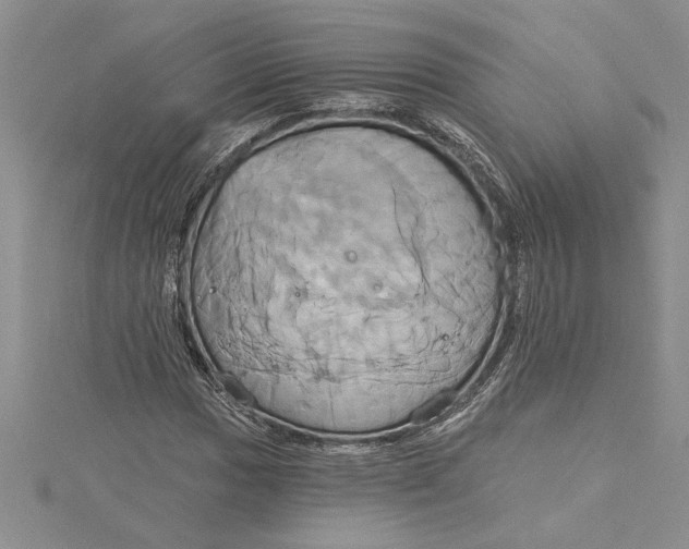 X0000115171017200911181401