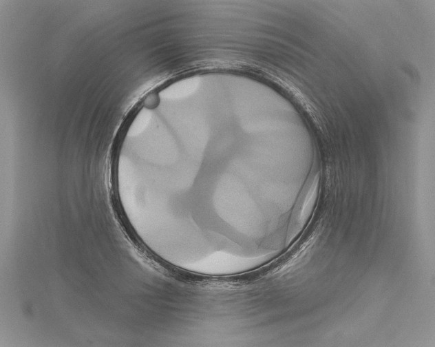 X0000115171034200911181401
