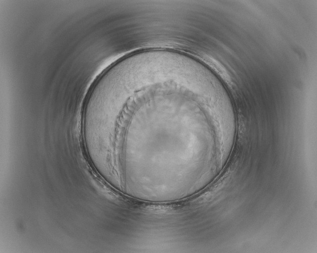 X0000115171044200911181401