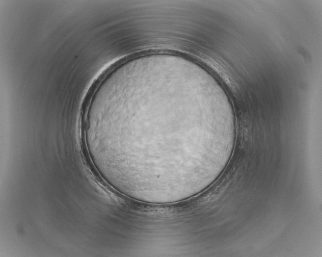 X0000115171076200911181400