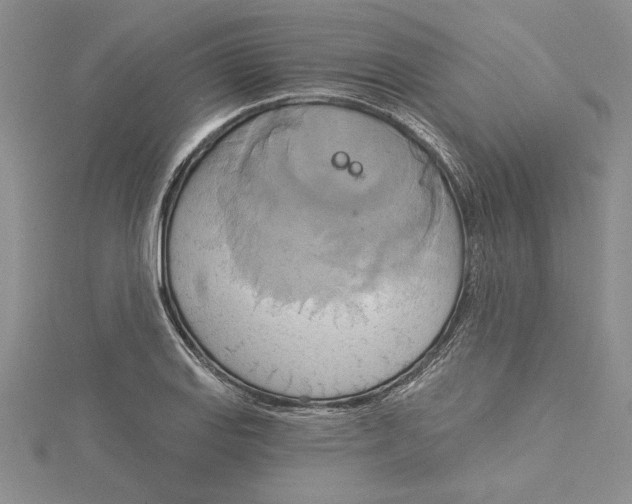 X0000115171127200911181400