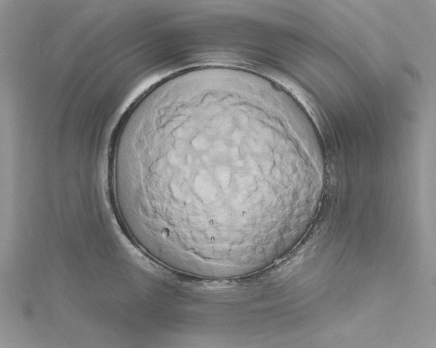 X0000115171147200911181400