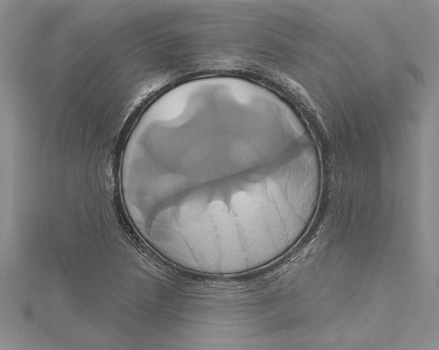 X0000115171218200911181358