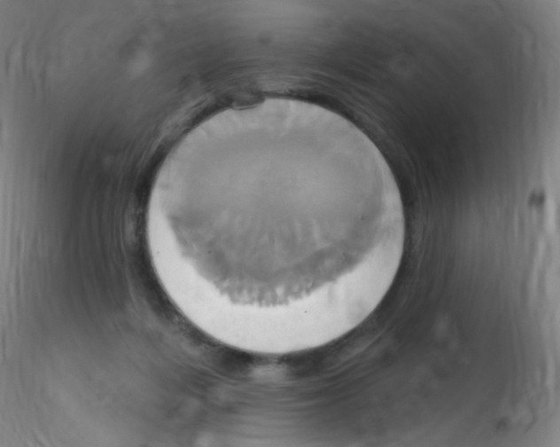 X0000115170216200911251341