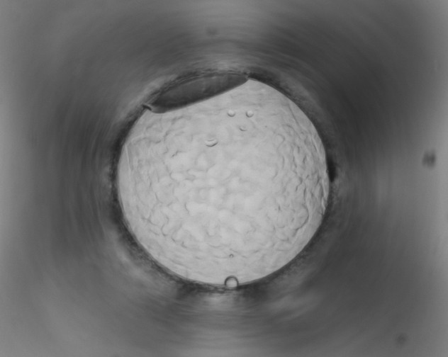 X0000115170306200911251340