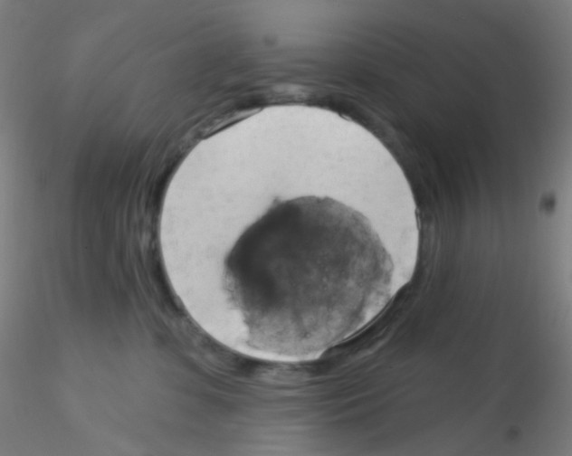 X0000115170331200911251339