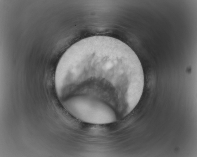 X0000115170515200911251337