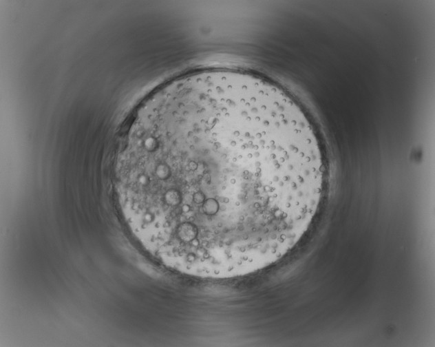 X0000115170529200911251336