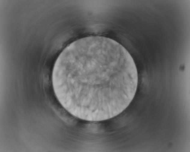 X0000115170615200911251335