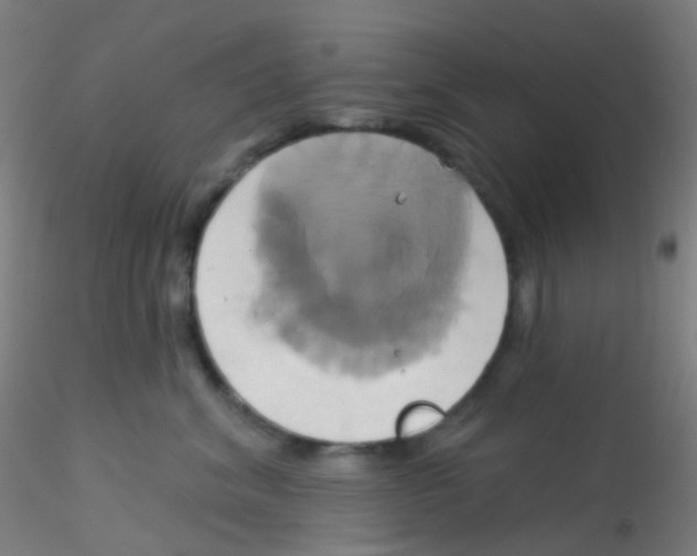 X0000115170620200911251335