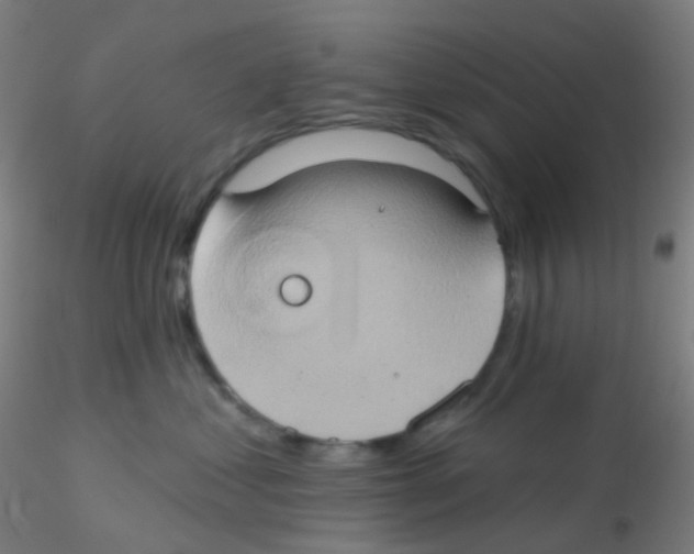 X0000115170621200911251335