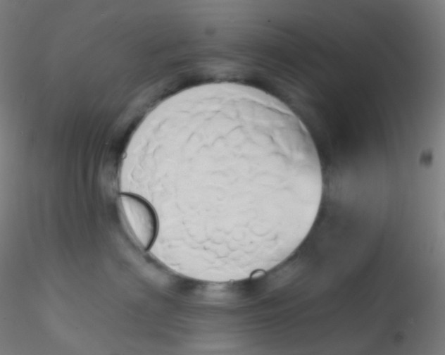 X0000115170622200911251335