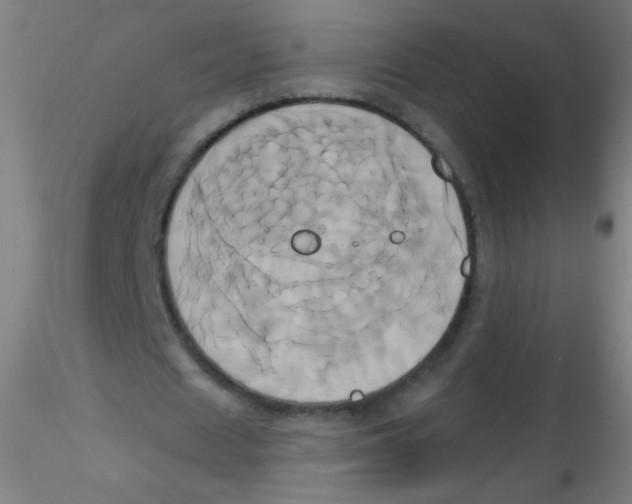 X0000115170625200911251334