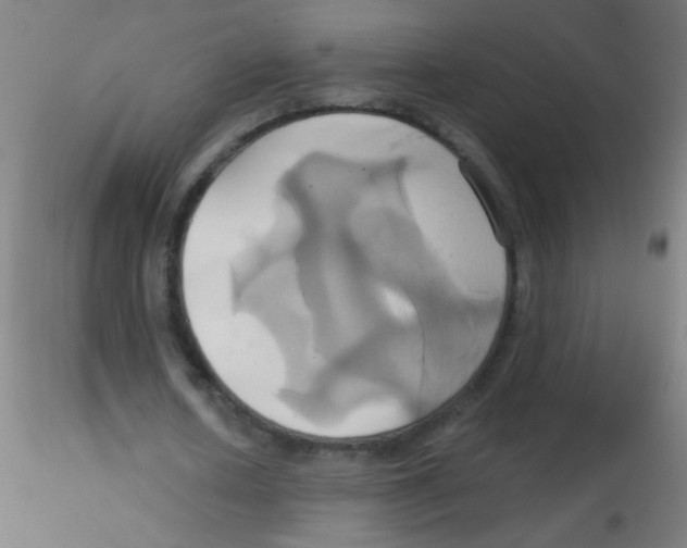 X0000115170626200911251335