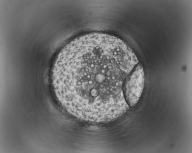 X0000115170635200911251335