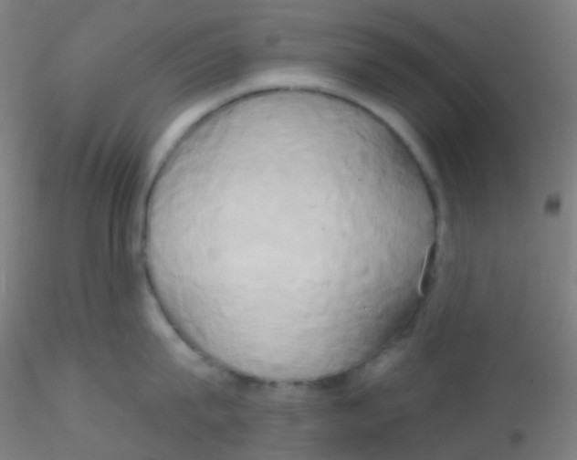 X0000115170815200911251332